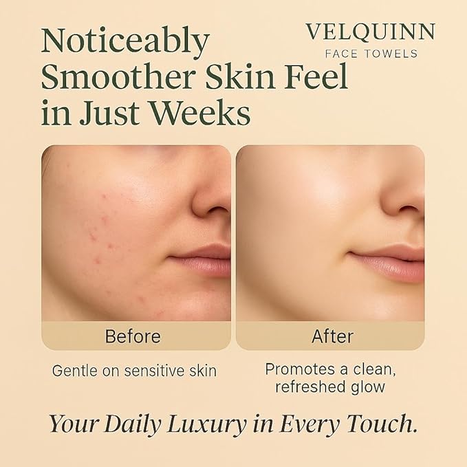 Velquinn Ultra Soft Face Towels, 100% Organic, Biodegradable, Hypoallergenic, Dermatologist Tested, 50 Count