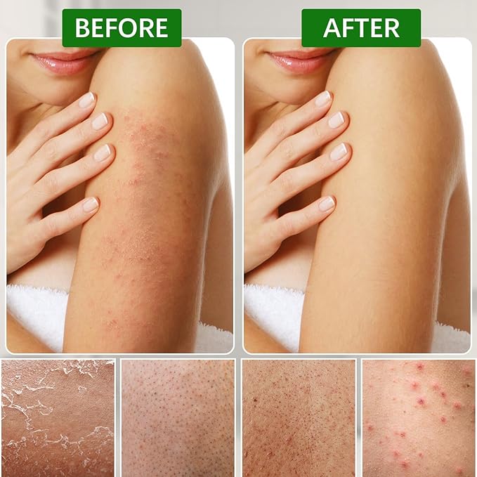 Tecbeauty 12Pcs Korean Exfoliating Bath Washcloths Mitt Scrubber for Body Removing Dead Skin